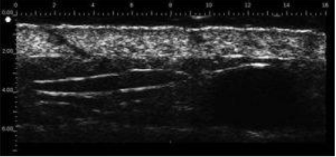 Dermatógrafo dedicado a la dermis DTC DERMCUP