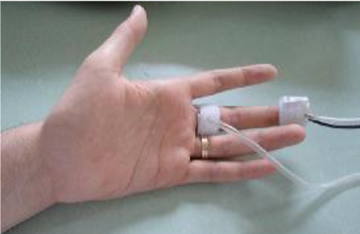 SysToe · Medición de la presión sistólica en el dedo del pie y el dedo