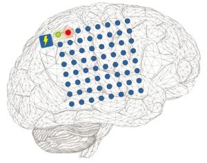 Cerebro con matriz de electrodos para estimulación cortical