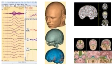 Software Sienna - Adquisición y revisión de EEG