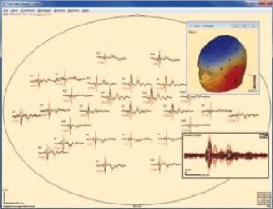 Software Sienna - Mapeo cerebral y análisis avanzado